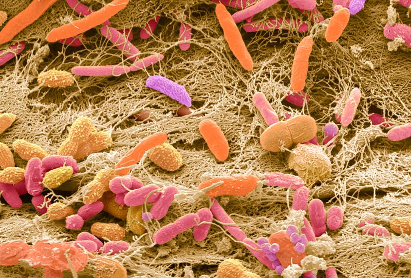 Microscopic photo of a microbiome.