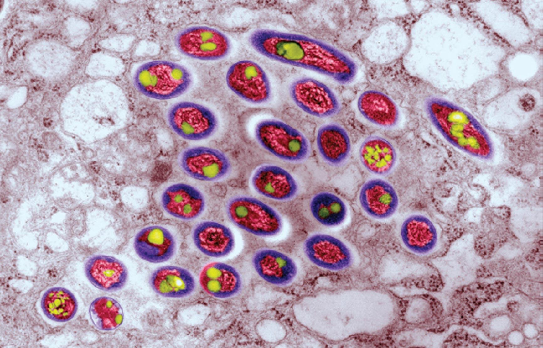 A microscopic image of fluorescently colored mycobacteria.